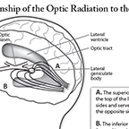 optic radiations illustration